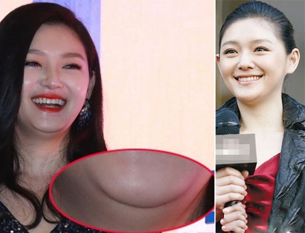 不能大笑的9位女明星，笑起来下巴全是肉，感觉能夹死一只苍蝇了(2)