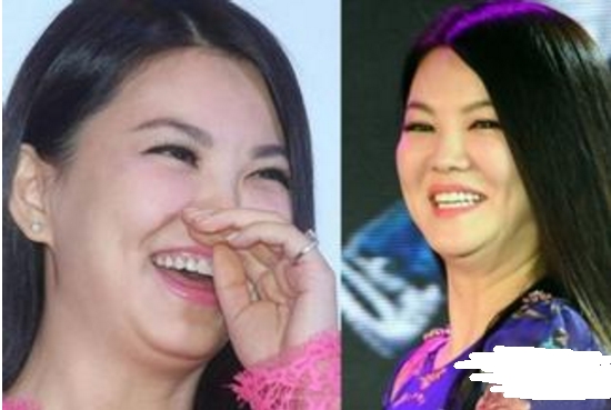 不能大笑的9位女明星，笑起来下巴全是肉，感觉能夹死一只苍蝇了(1)