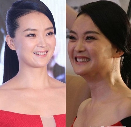 不能大笑的9位女明星，笑起来下巴全是肉，感觉能夹死一只苍蝇了(1)