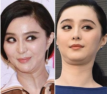 不能大笑的9位女明星，笑起来下巴全是肉，感觉能夹死一只苍蝇了(3)