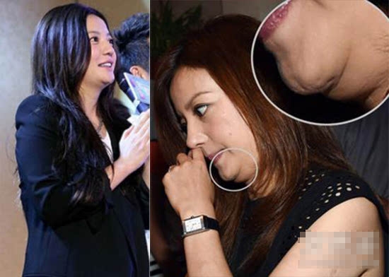 不能大笑的9位女明星，笑起来下巴全是肉，感觉能夹死一只苍蝇了(1)