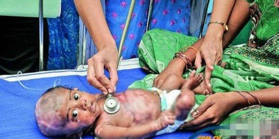 诡异！男婴无故出现自燃情况 医生无解(1)