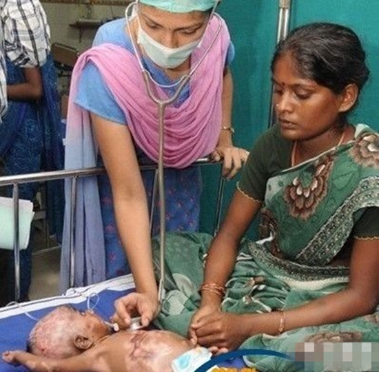 诡异！男婴无故出现自燃情况 医生无解(1)