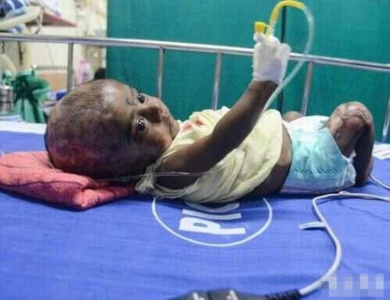 诡异！男婴无故出现自燃情况 医生无解(2)