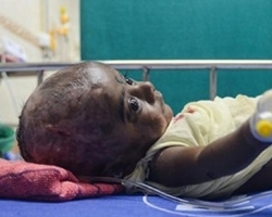 诡异！男婴无故出现自燃情况 医生无解